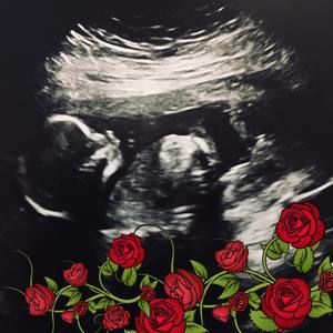 Meet your Posher, Sonja